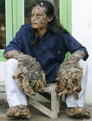 Illustration for article titled 10 Unusual Genetic Mutations in Humans